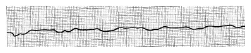 EKG Test - ProProfs Quiz